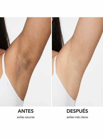 Crema Aclarante De Zonas Oscuras